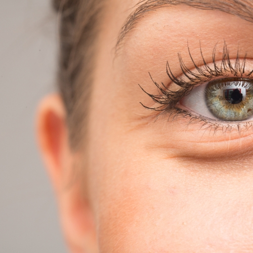 Eyelid Surgery model 02 2x, Dr Peters Brisbane